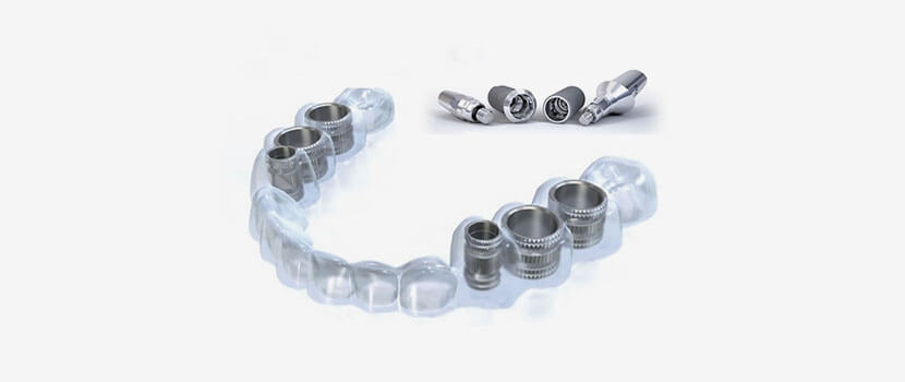 インプラント治療の安全性を高め、患者さまの負担を減らす